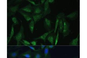 Immunofluorescence analysis of U-2 OS cells using CAMLG Polyclonal Antibody at dilution of 1:100 (40x lens). (CAMLG Antikörper)