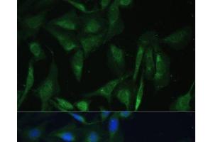 Immunofluorescence analysis of U-2 OS cells using CAMLG Polyclonal Antibody at dilution of 1:100 (40x lens). (CAMLG Antikörper)