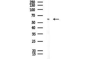 anti-CDK5 Regulatory Subunit Associated Protein 3 (CDK5RAP3) antibody
