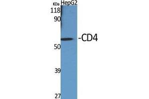 Western Blotting (WB) image for anti-CD4 (CD4) (Ser213) antibody (ABIN3183771)