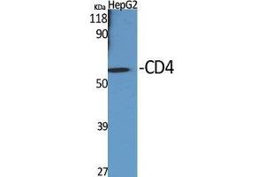 Western Blot (WB) analysis of specific cells using CD4 Polyclonal Antibody. (CD4 Antikörper  (Ser213))