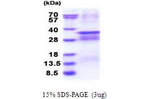 OSR2 Protein (AA 1-276) (His tag)