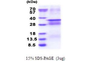 SDS-PAGE (SDS) image for Odd-Skipped Related 2 (OSR2) (AA 1-276) protein (His tag) (ABIN5853854)