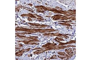 Immunohistochemical staining of human smooth muscle with ARL6IP1 polyclonal antibody ( Cat # PAB28311 ) shows strong cytoplasmic positivity in smooth muscle cells. (ARL6IP1 Antikörper)