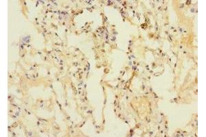 Immunohistochemistry of paraffin-embedded human lung tissue using ABIN7150754 at dilution of 1:100 (DUSP16 Antikörper  (AA 416-665))