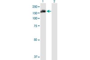 Western Blot analysis of FAM62A expression in transfected 293T cell line by FAM62A MaxPab polyclonal antibody. (ESYT1 Antikörper  (AA 1-1104))