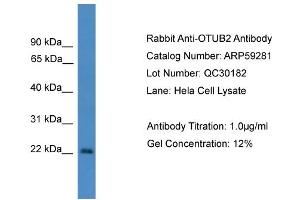 WB Suggested Anti-OTUB2  Antibody Titration: 0. (OTUB2 Antikörper  (N-Term))