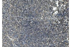 IHC analysis of FLI1 using anti-FLI1 antibody (ABIN7599409). (FLI1 Antikörper  (AA 1-452))