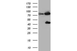 Image no. 1 for anti-Coagulation Factor XIII, A1 Polypeptide (F13A1) antibody (ABIN1498155) (F13A1 Antikörper)