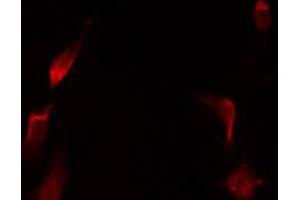 Immunofluorescence (fixed cells) (IF/ICC) image for anti-Nuclear Factor of Activated T-Cells, Cytoplasmic, Calcineurin-Dependent 3 (NFATC3) (pSer165) antibody (ABIN6256165)