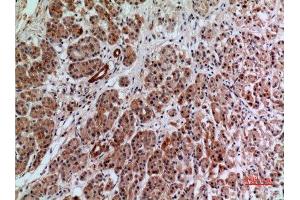 Immunohistochemistry (IHC) image for anti-Annexin A7 (ANXA7) (Internal Region) antibody (ABIN6282754)