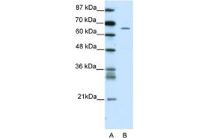 WB Suggested Anti-ZNF205 Antibody Titration:  5. (ZNF205 Antikörper  (N-Term))
