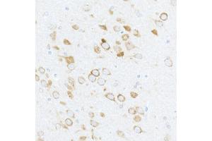 Immunohistochemistry of paraffin-embedded rat brain using Phospho-S6 Ribosomal Protein (RPS6)-S240/244 Rabbit pAb (ABIN6135311, ABIN6136242, ABIN6136243 and ABIN6225563) at dilution of 1:50 (40x lens). (RPS6 Antikörper  (pSer240, pSer244))