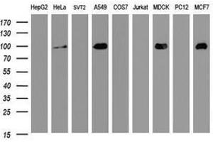 Image no. 1 for anti-Cadherin 1, Type 1, E-Cadherin (Epithelial) (CDH1) antibody (ABIN1497942) (E-cadherin Antikörper)