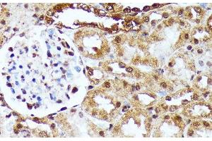 Immunohistochemistry of paraffin-embedded Rat kidney using YAP1 Polyclonal Antibody at dilution of 1:100 (40x lens). (YAP1 Antikörper)