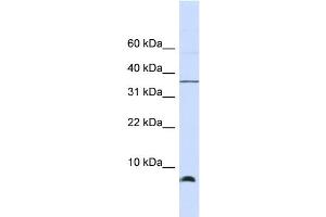WB Suggested Anti-HSPE1 Antibody Titration: 0. (HSPE1 Antikörper  (Middle Region))
