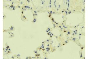 ABIN6273899 at 1/100 staining Mouse lung tissue by IHC-P.