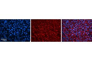 Rabbit Anti-ZNF259 Antibody   Formalin Fixed Paraffin Embedded Tissue: Human Liver Tissue Observed Staining: Cytoplasm in hepatocytes Primary Antibody Concentration: N/A Other Working Concentrations: 1:600 Secondary Antibody: Donkey anti-Rabbit-Cy3 Secondary Antibody Concentration: 1:200 Magnification: 20X Exposure Time: 0. (ZNF259 Antikörper  (N-Term))