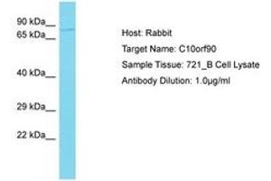 Image no. 1 for anti-Chromosome 10 Open Reading Frame 90 (C10ORF90) (AA 491-540) antibody (ABIN6750549)