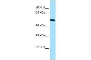 WB Suggested Anti-ACTR6 Antibody Titration: 1. (ACTR6 Antikörper  (C-Term))