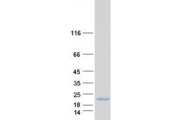 SMAGP Protein (Transcript Variant 1) (Myc-DYKDDDDK Tag)