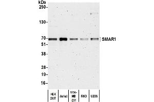Western Blotting (WB) image for anti-Protein BANP (BANP) (C-Term) antibody (ABIN7453906) (BANP Antikörper  (C-Term))