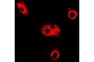 Immunofluorescent analysis of ADSL staining in Hela cells.