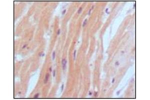 Immunohistochemical analysis of paraffin-embedded human normal myocardium, showing cytoplasmic localization using BNP2 mouse mAb with DAB staining. (BNP Antikörper)