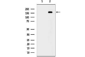 anti-Death-Associated Protein Kinase 1 (DAPK1) (Internal Region) antibody