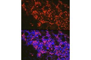 Immunofluorescence analysis of mouse bone marrow cells using FADD Rabbit pAb (ABIN7267137) at dilution of 1:100 (40x lens). (FADD Antikörper)