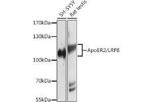 Western blot analysis of extracts of various cell lines, using ApoER2/ApoER2/LRP8 antibody (ABIN6134224, ABIN6143337, ABIN6143338 and ABIN6214801) at 1:1000 dilution. (LRP8 Antikörper  (C-Term))