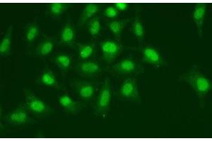 Immunofluorescence (IF) image for anti-Polymerase (DNA Directed), delta 1, Catalytic Subunit 125kDa (POLD1) antibody (ABIN7010566)