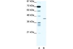 WB Suggested Anti-PPARD Antibody Titration:  1. (PPARD Antikörper  (Middle Region))