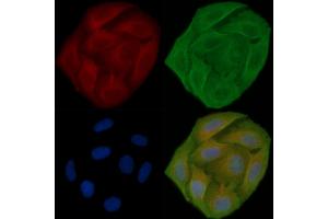ABIN6257703 and ABIN6273923 staining Hela cells(30 min of UV treatment) by IF/ICC. (CCKBR Antikörper  (N-Term))