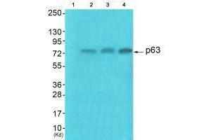 Western blot analysis of extracts from HuvEc cells (Lane 2), JK cells (Lane 3) and cos-7 cells (Lane4), using p63 antiobdy.