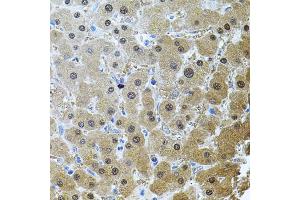 Immunohistochemistry of paraffin-embedded human liver injury using RNF166 antibody (ABIN5974659) (40x lens). (RNF166 Antikörper)