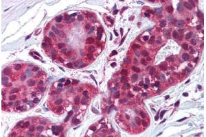 Human Breast (formalin-fixed, paraffin-embedded) stained with TIMP2 antibody ABIN214221 at 10 µg/ml followed by biotinylated anti-mouse IgG secondary antibody ABIN481714, alkaline phosphatase-streptavidin and chromogen. (TIMP2 Antikörper)