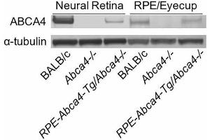 Immunoblot of retina and RPE homogenates from BALB/c, Abca4−/−, and RPE-Abca4-Tg/Abca4−/− mice (all albino) reacted with antisera against ABCA4 or alpha-tubulin.