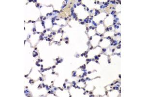 Immunohistochemistry of paraffin-embedded mouse lung using INTS6 Antibody. (INTS6 Antikörper  (AA 1-280))