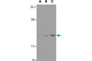 Western blot analysis of BAX in HL-60 cell lysates with BAX polyclonal antibody  at (A) 1, (B) 2, and (C) 4 ug/mL . (BAX Antikörper  (N-Term))