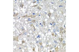 Immunohistochemistry of paraffin-embedded rat brain using C1GALT1C1 antibody at dilution of 1:100 (x40 lens). (C1GALT1C1 Antikörper)