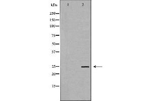 Western blot analysis of Hela whole cell lysates, using TK1 Antibody. (TK1 Antikörper  (N-Term))