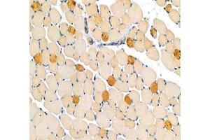 Immunohistochemistry analysis of paraffin-embedded mouse legmuscle using MYH7 (ABIN7075623) at dilution of 1: 100 (Slow Skeletal Myosin Heavy Chain Antikörper)