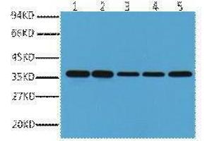 Western Blotting (WB) image for anti-Glyceraldehyde-3-Phosphate Dehydrogenase (GAPDH) antibody (ABIN3178582) (GAPDH Antikörper)