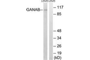 Western blot analysis of extracts from LOVO cells, using GANAB Antibody. (GANAB Antikörper  (AA 242-291))