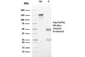 SDS-PAGE Analysis Purified Perforin-1 Monospecific Mouse Monoclonal Antibody (PRF1/2470). (Perforin 1 Antikörper  (AA 413-552))