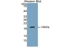 Western blot analysis of the recombinant protein. (Pleiotrophin Antikörper  (AA 33-168))