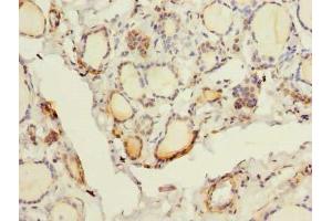 Immunohistochemistry of paraffin-embedded human thyroid tissue using ABIN7153260 at dilution of 1:100 (FYCO1 Antikörper  (AA 2-255))