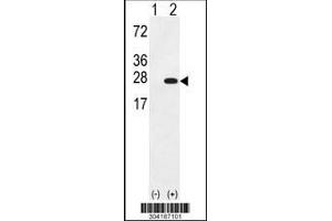 Western blot analysis of his tag antibody in UCHL3 gene transfected 293 lysates (35ug/lane).