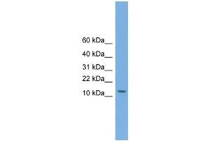 WB Suggested Anti-MAGEA5 Antibody Titration:  0. (MAGEA5 Antikörper  (N-Term))